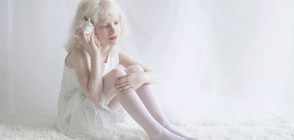 Хипнотизиращата красота на албиносите (ГАЛЕРИЯ)
