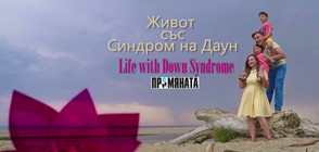 Известните личности в България са призовани да подкрепят Международния ден на хората със Синдром на Даун