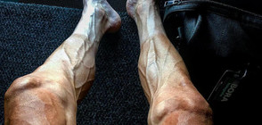Шокиращи снимки на краката на колоездач след "Тур дьо Франс"