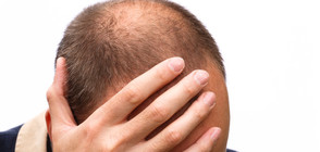 Учени откриха нов начин за борба с оплешивяването