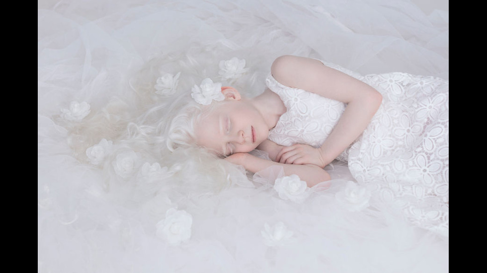 Красотата на хората албиноси