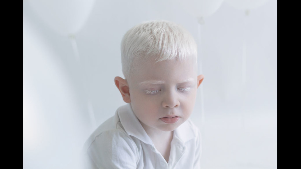 Красотата на хората албиноси