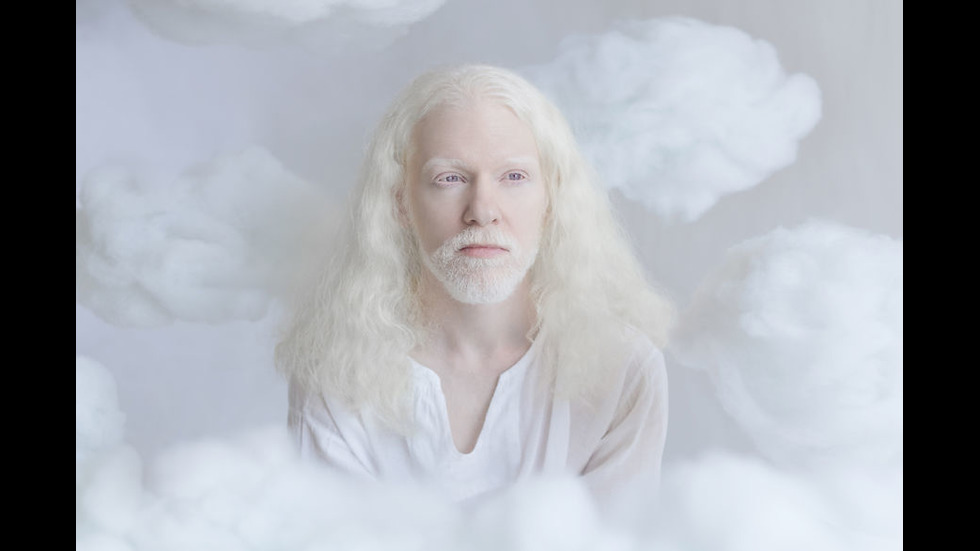 Красотата на хората албиноси