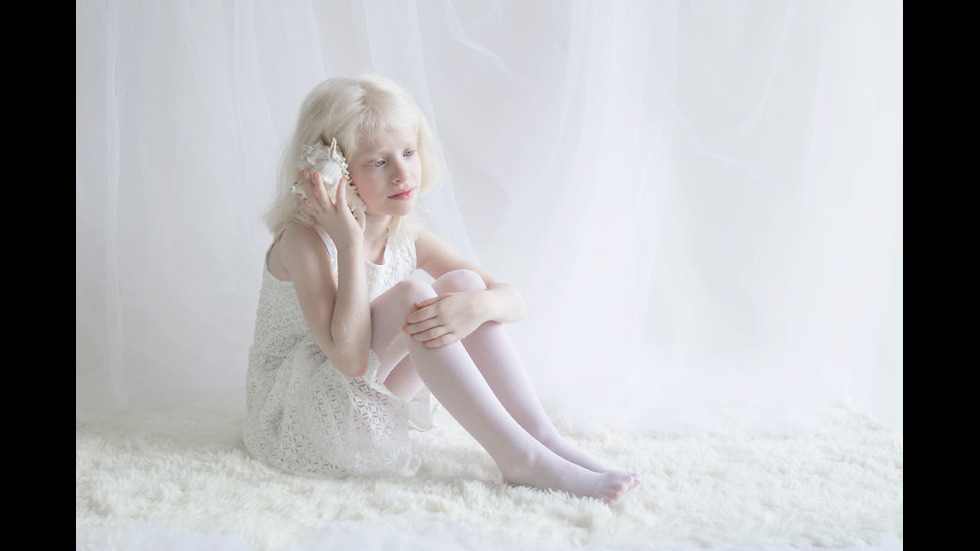 Красотата на хората албиноси