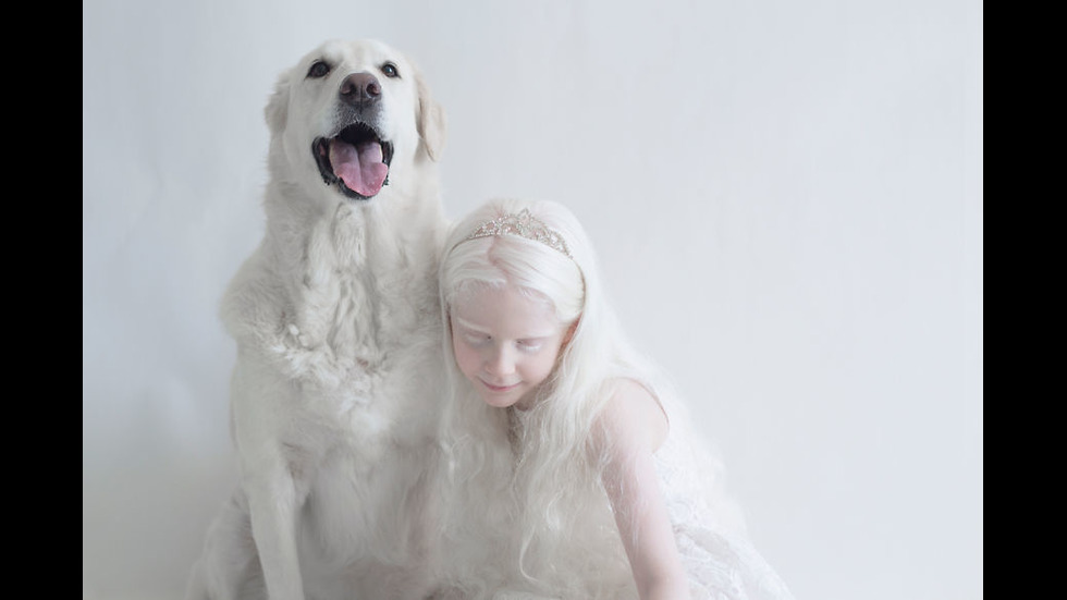 Красотата на хората албиноси