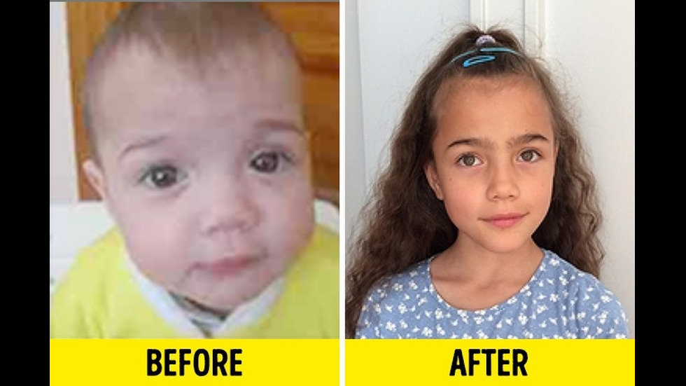 12 снимки на деца преди и след осиновяването
