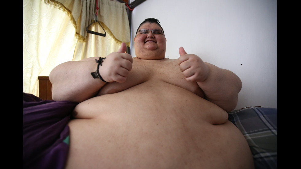 Един от най-дебелите хора в света е отслабнал със 175 килограма