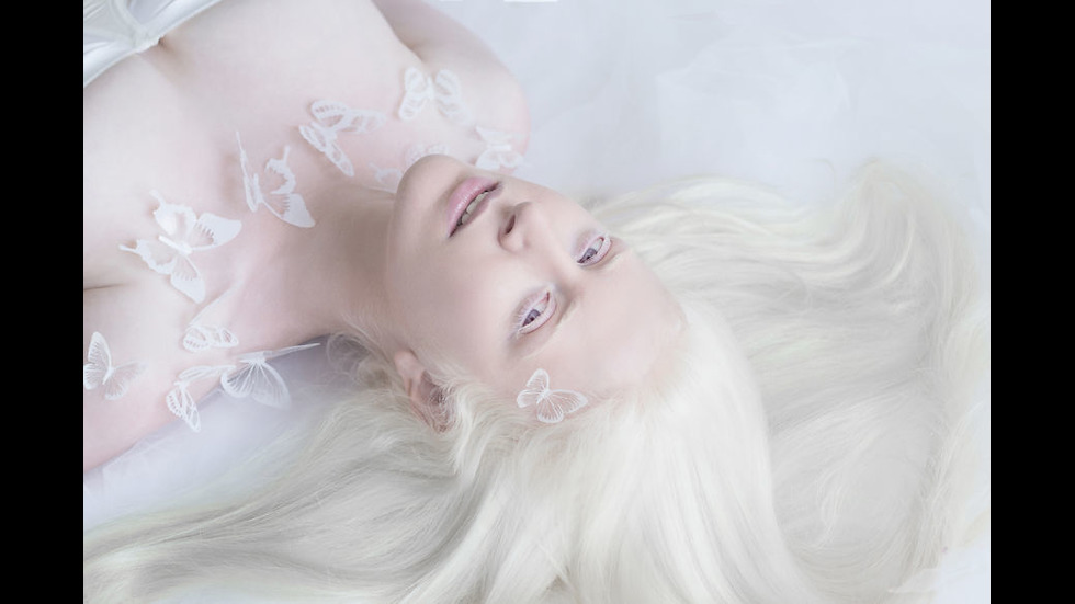 Красотата на хората албиноси