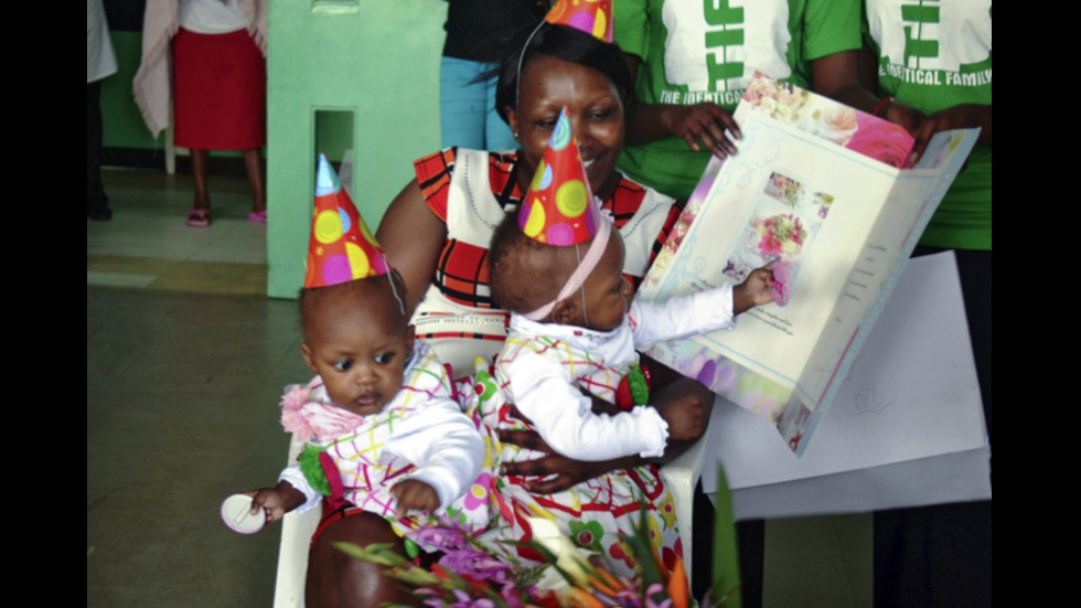 В Кения разделиха сиамски близначки