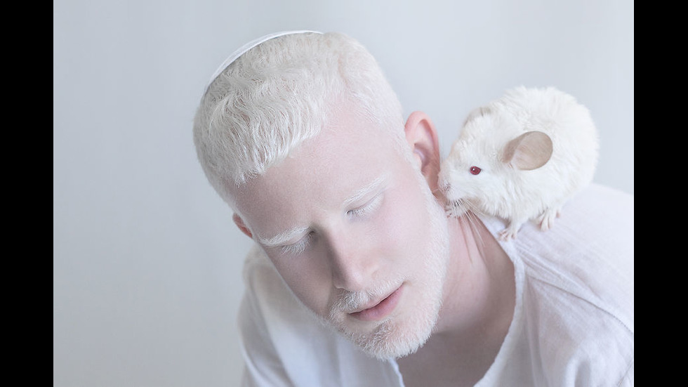 Красотата на хората албиноси