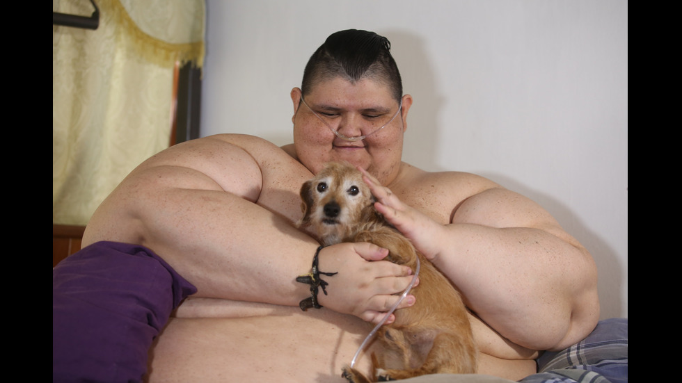 Един от най-дебелите хора в света е отслабнал със 175 килограма