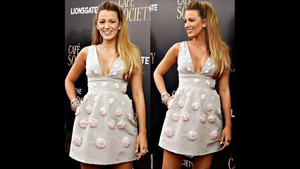 Пластичните операции на звездите